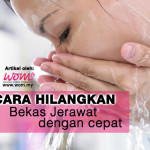 10 Cara Menghilangkan Bekas Jerawat Dengan Cepat