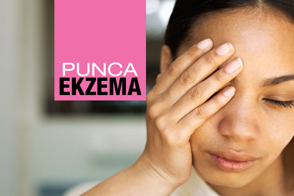 PUNCA EKZEMA - women online magazine