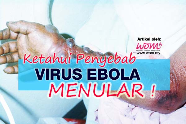 Penyebab Virus Ebola - women online magazine