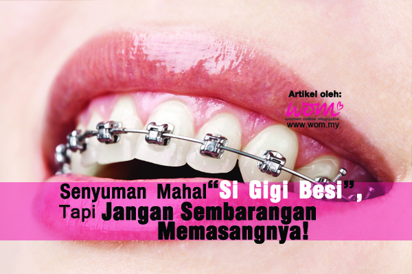 pendakap gigi - women online magazine