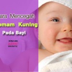 7 Punca Penyakit Kuning Pada Bayi