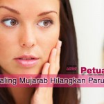 8 Petua Hilangkan Parut