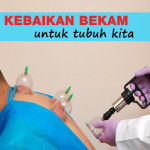 4 Kebaikan Bekam Buat Tubuh Manusia